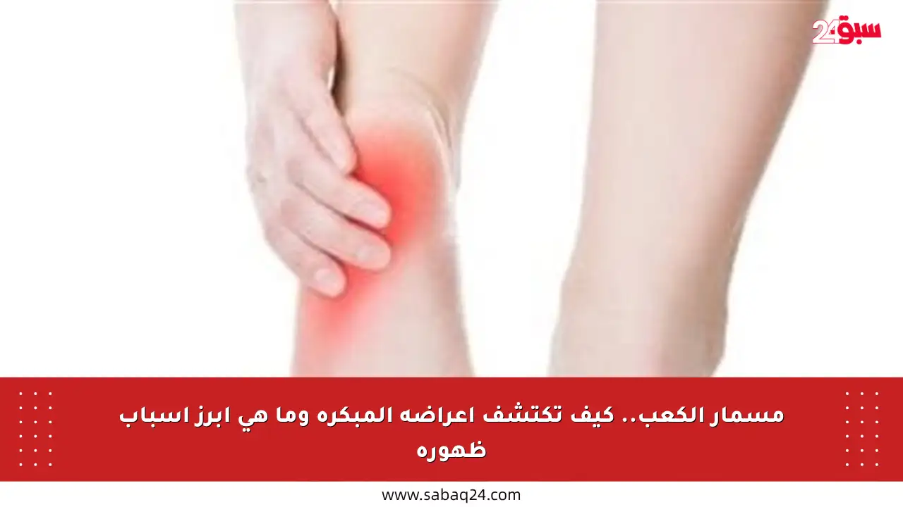 مسمار الكعب.. كيف تكتشف أعراضه المبكرة وما هي أبرز أسباب ظهوره